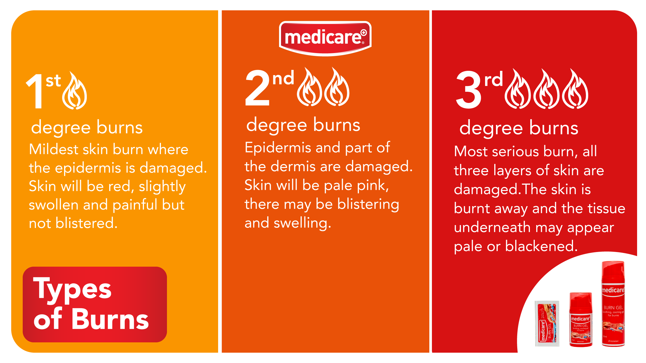 Types of Burns