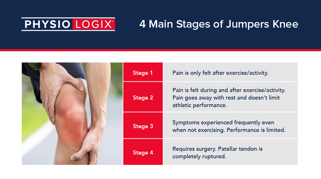 4 Stages of Jumpers Knee