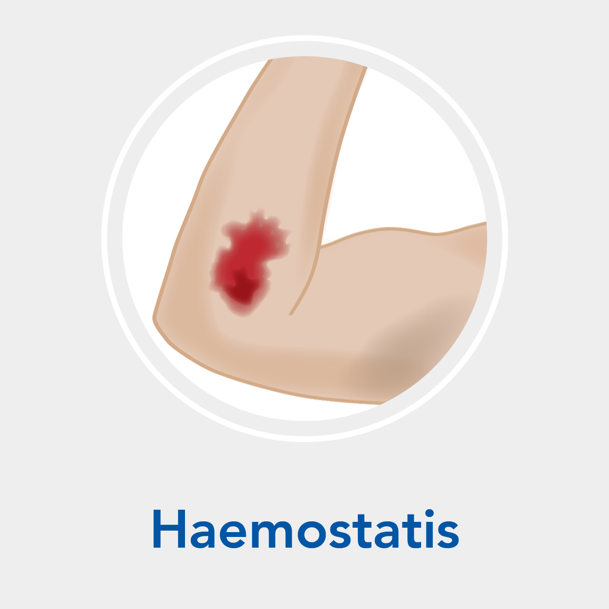 Stage 1: Haemostatis