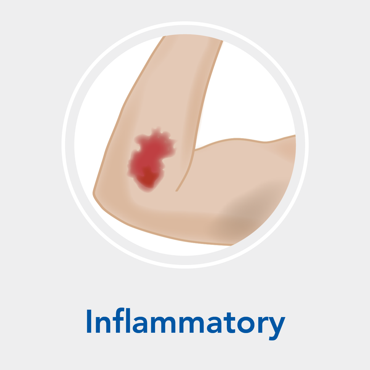 How to tell if a wound is healing or infected