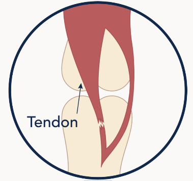 Tendons