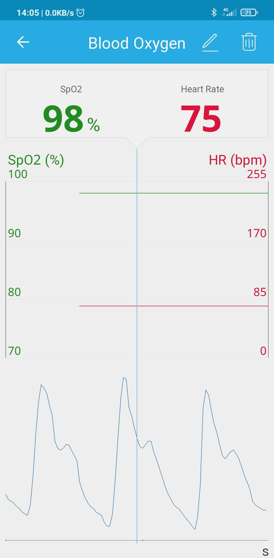 Pulse Oximeter SPO2
