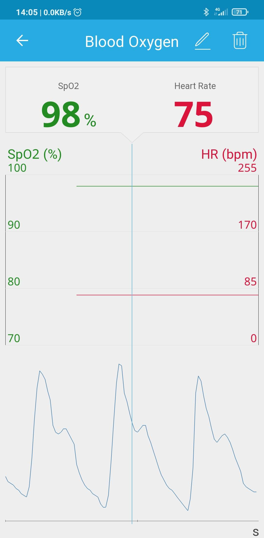Pulse Oximeter SPO2 Pulse Oximeter SPO2