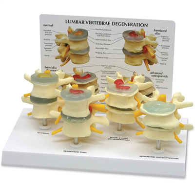 VERTEBRAE 4-STAGE MODEL