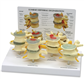 VERTEBRAE 4-STAGE MODEL