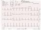 SCHILLER PAPER FOR MS-2015 ECG